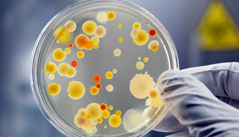 overhead view of petri dish and scientist's gloved hand